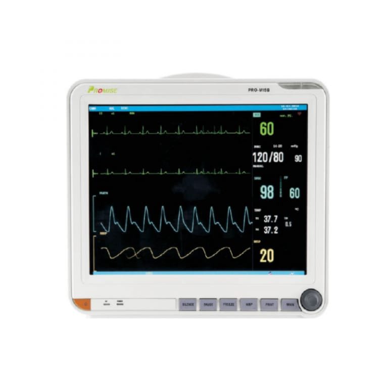 Monitor de 15” TOUCH SIN IMPRESORA