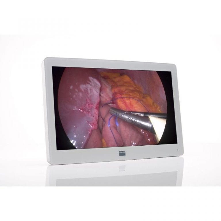 Monitor Quirurgico LED FULL HD de 26" 2MP